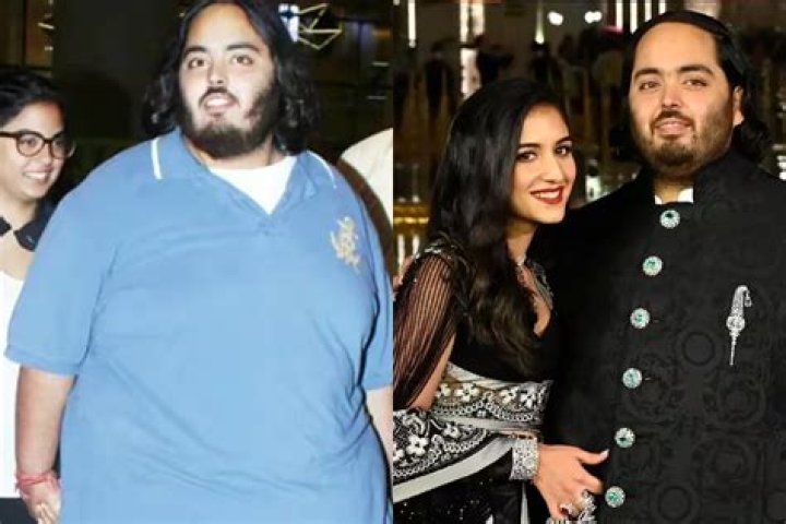 Anant Ambani reportedly gained weight due to steroids to treat his