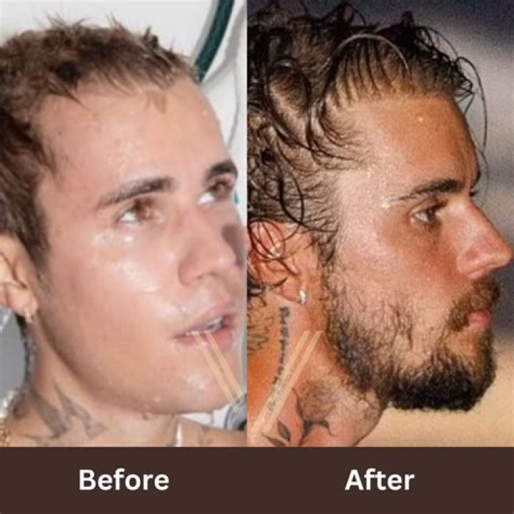 Justin Bieber, Before and After Transformation 2018!