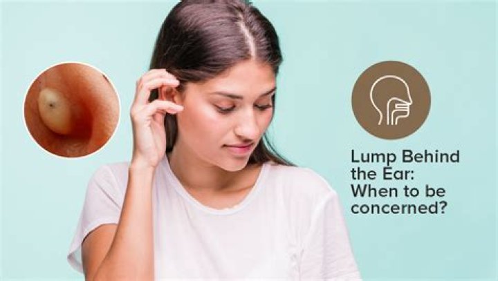 Lumps Behind the Ear 6 Causes & When to See a Doctor Tua Saúde