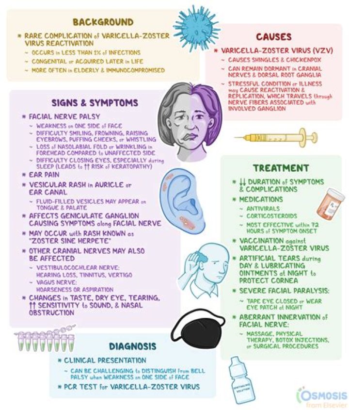 Ramsay Hunt Syndrome Therapy