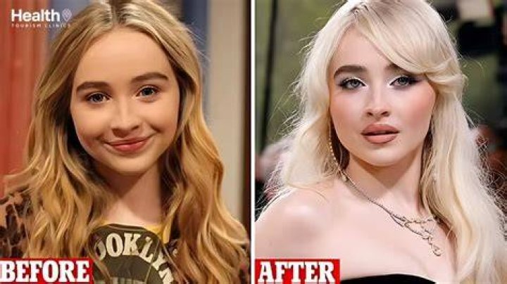 Sabrina Carpenter Plastic Surgery Did She Have Any Cosmetic Enhancements?