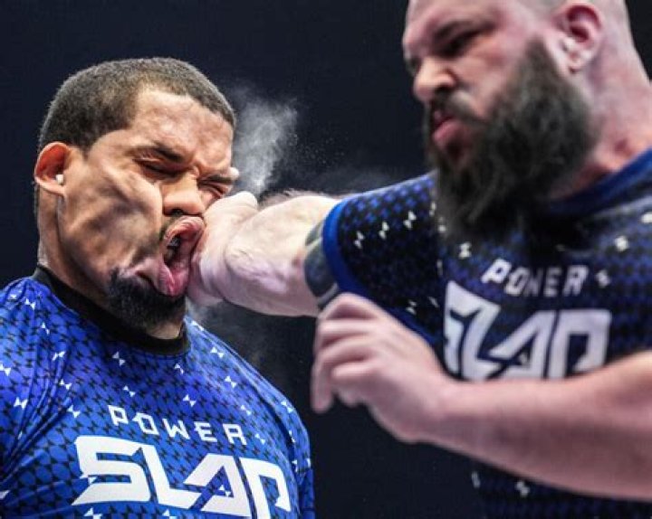 Slap Fighting Fighter&rsquo;s face left disfigured, video, Sorin Comsa, reaction, Dana White NT News