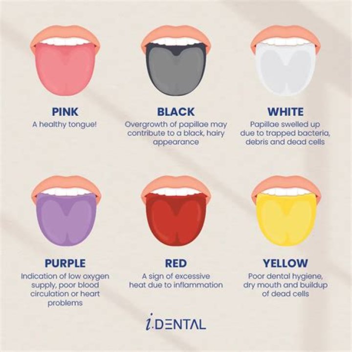 What does it mean when someone stares at you? Body Language Central